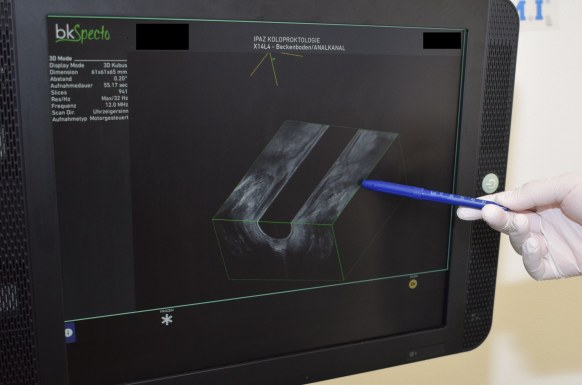 3D-Sonographie-Gerät
